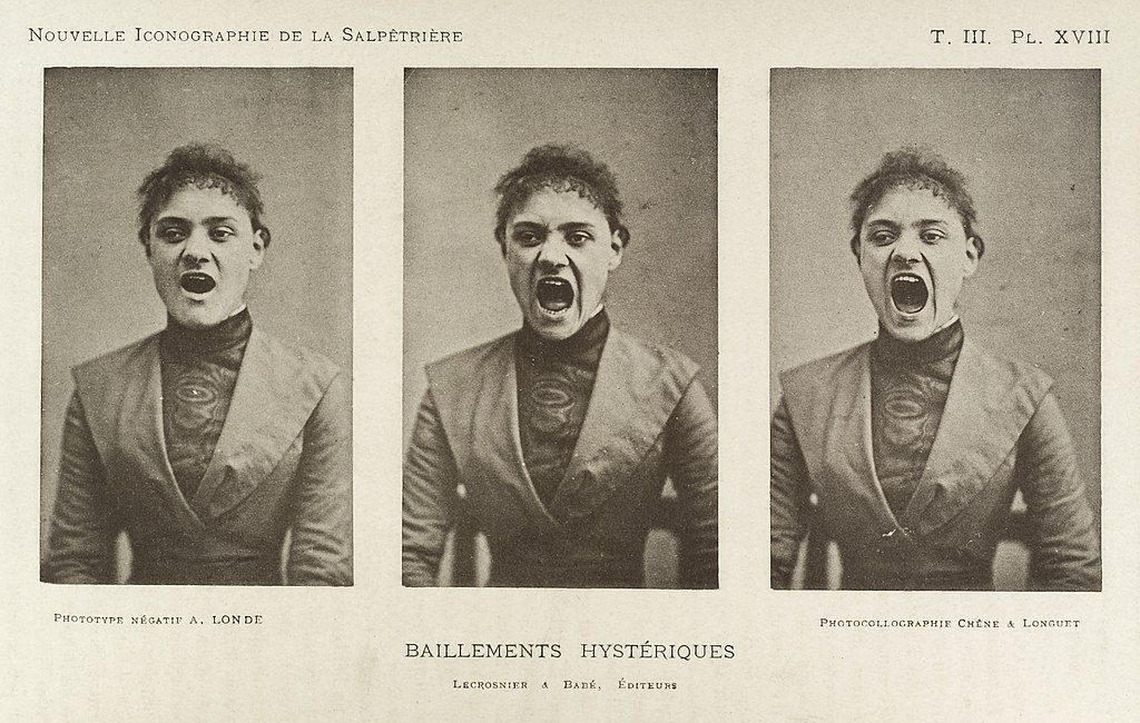 Trois photos d'une série montrant une femme hystérique en train de bâiller. Vers 1890. Source : Hôpital Pitié-Salpêtrière, Collection Bourneville.